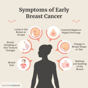 Breast Cancer image